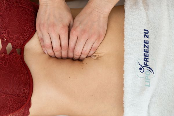 diastasis recti treatment Bicester
