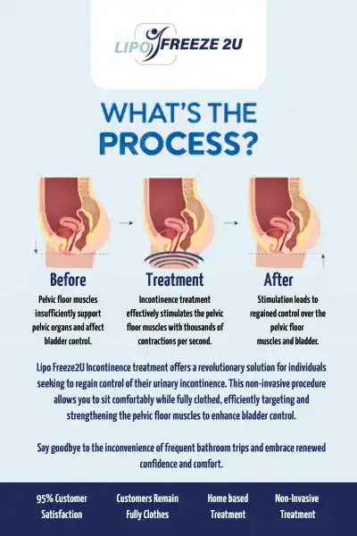 Diagram of how incontinence treatment Bicester works.