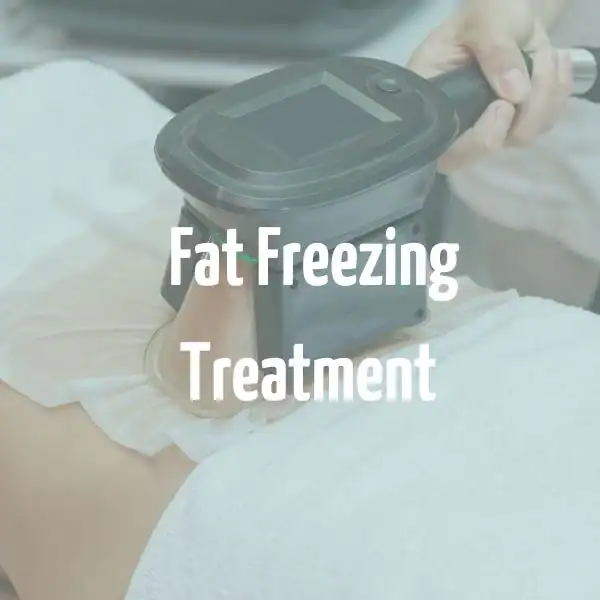fat freezing treatment Bicester