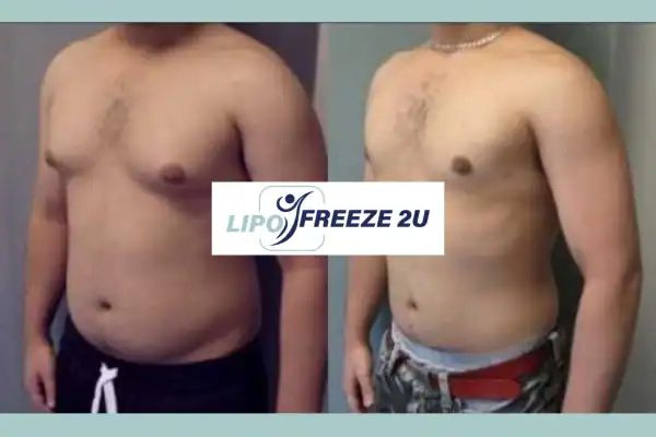 How Long Does It Take to See Results Bicester?