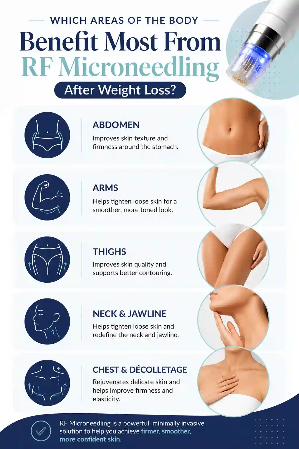 Which Areas of the Body Benefit Most From RF Microneedling After Weight Loss Bicester